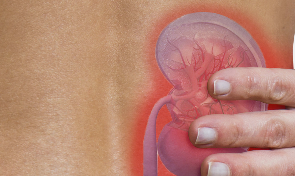 Image Types of Kidney stones mobile